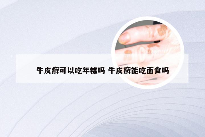 牛皮癣可以吃年糕吗 牛皮癣能吃面食吗