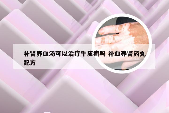 补肾养血汤可以治疗牛皮癣吗 补血养肾药丸配方