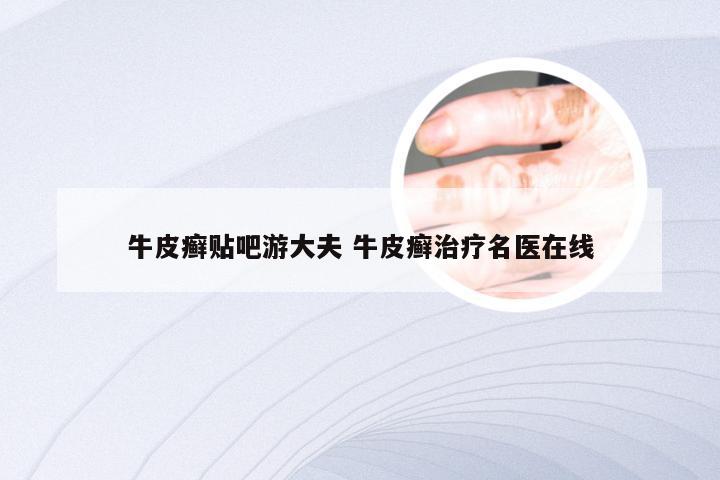 牛皮癣贴吧游大夫 牛皮癣治疗名医在线