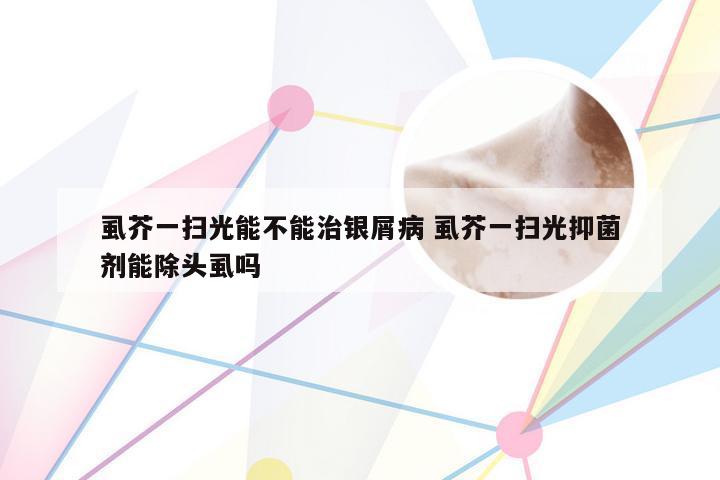 虱芥一扫光能不能治银屑病 虱芥一扫光抑菌剂能除头虱吗