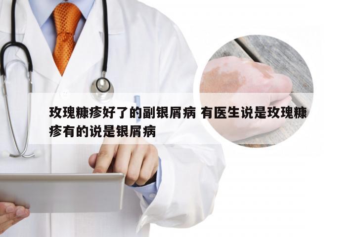 玫瑰糠疹好了的副银屑病 有医生说是玫瑰糠疹有的说是银屑病
