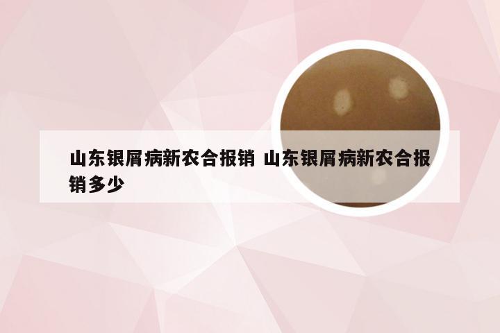 山东银屑病新农合报销 山东银屑病新农合报销多少