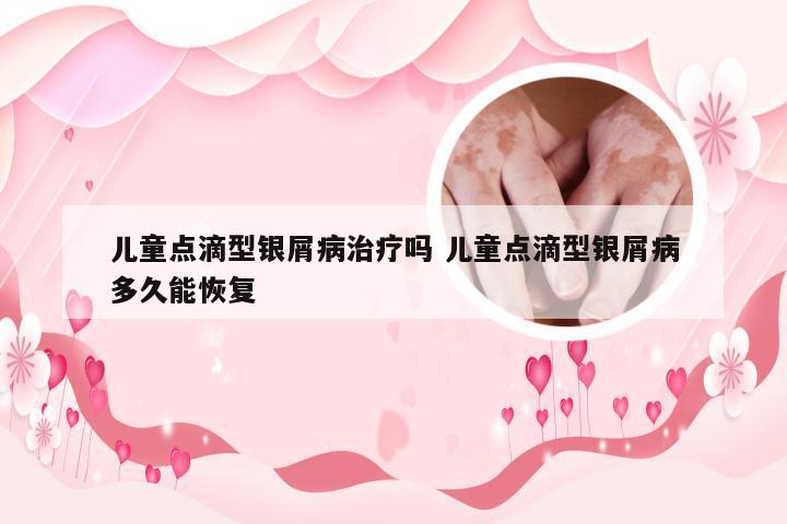 儿童点滴型银屑病治疗吗 儿童点滴型银屑病多久能恢复