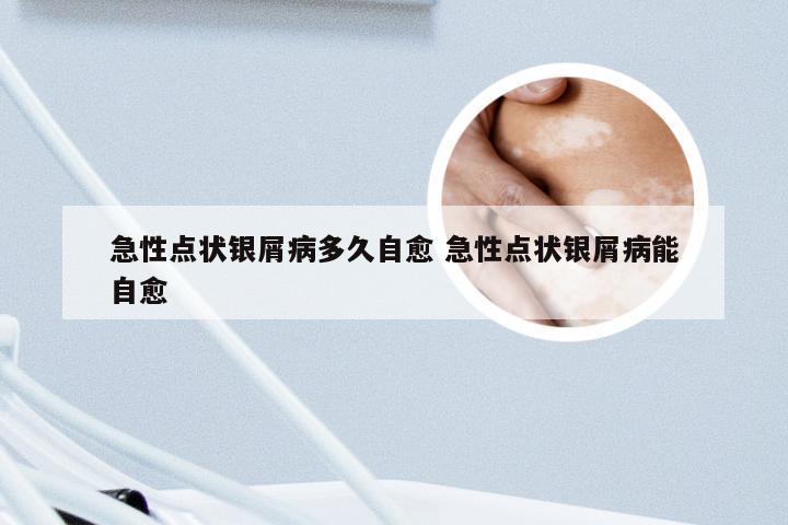 急性点状银屑病多久自愈 急性点状银屑病能自愈