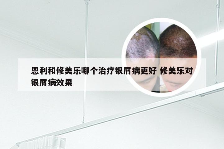 恩利和修美乐哪个治疗银屑病更好 修美乐对银屑病效果