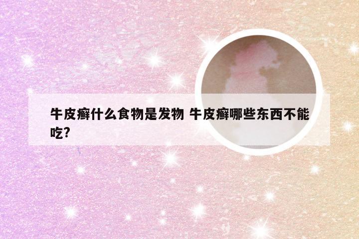 牛皮癣什么食物是发物 牛皮癣哪些东西不能吃?