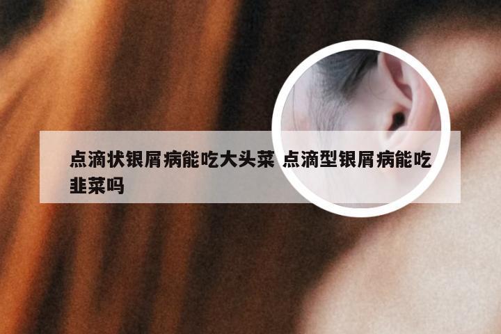 点滴状银屑病能吃大头菜 点滴型银屑病能吃韭菜吗