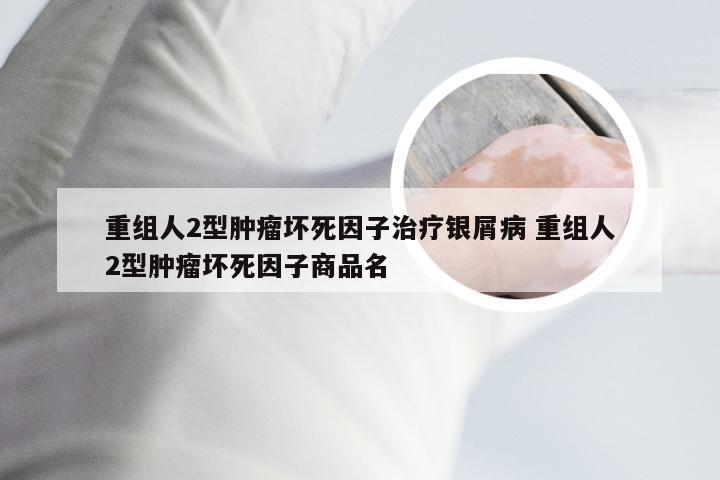 重组人2型肿瘤坏死因子治疗银屑病 重组人2型肿瘤坏死因子商品名