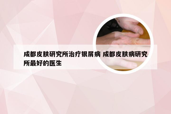 成都皮肤研究所治疗银屑病 成都皮肤病研究所最好的医生