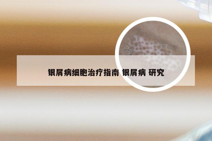 银屑病细胞治疗指南 银屑病 研究