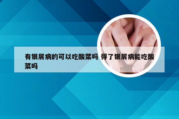 有银屑病的可以吃酸菜吗 得了银屑病能吃酸菜吗