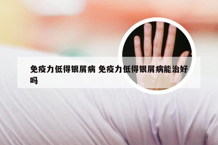 免疫力低得银屑病 免疫力低得银屑病能治好吗