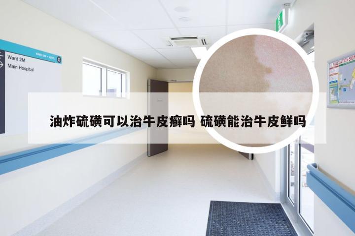 油炸硫磺可以治牛皮癣吗 硫磺能治牛皮鲜吗