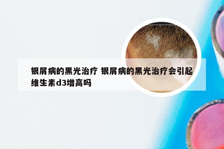 银屑病的黑光治疗 银屑病的黑光治疗会引起维生素d3增高吗