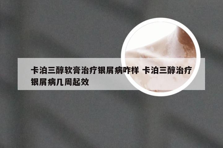 卡泊三醇软膏治疗银屑病咋样 卡泊三醇治疗银屑病几周起效