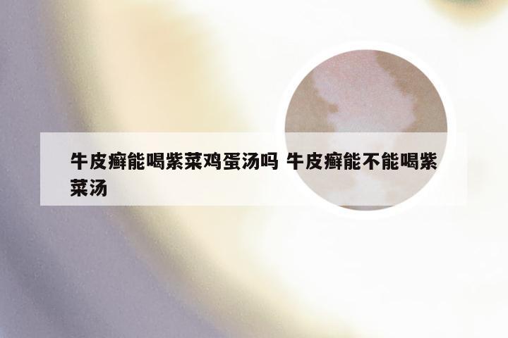 牛皮癣能喝紫菜鸡蛋汤吗 牛皮癣能不能喝紫菜汤