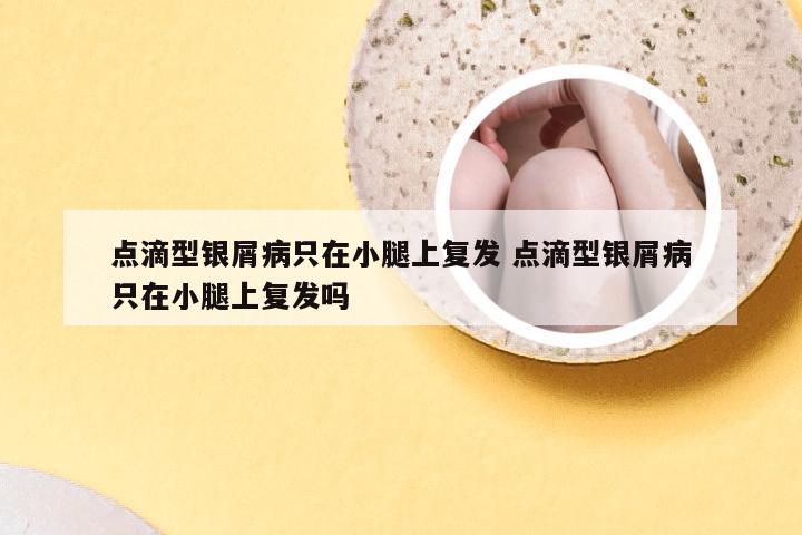 点滴型银屑病只在小腿上复发 点滴型银屑病只在小腿上复发吗