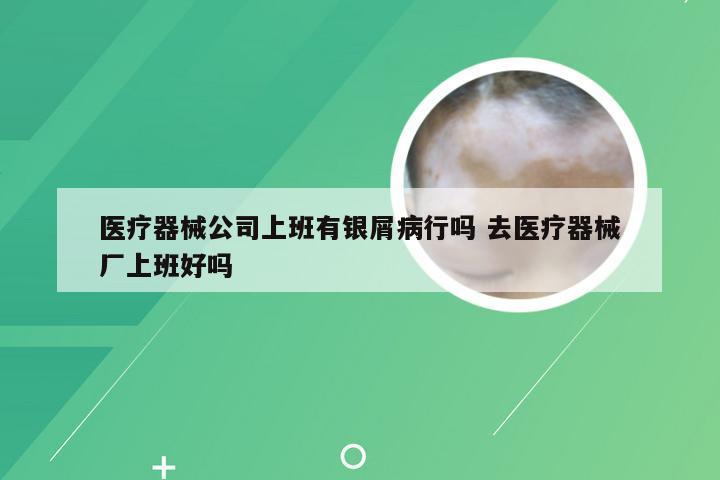 医疗器械公司上班有银屑病行吗 去医疗器械厂上班好吗