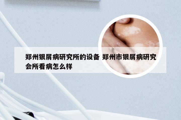 郑州银屑病研究所的设备 郑州市银屑病研究会所看病怎么样
