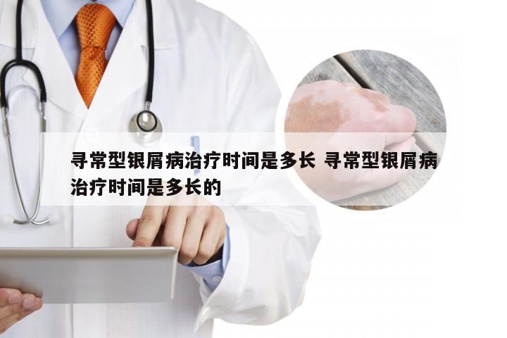 寻常型银屑病治疗时间是多长 寻常型银屑病治疗时间是多长的