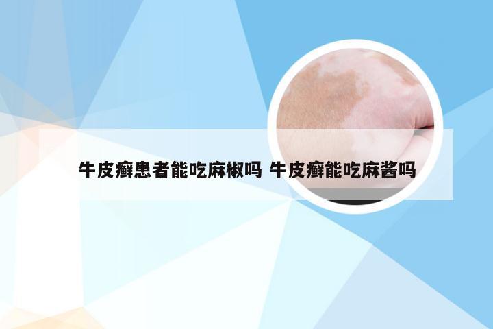 牛皮癣患者能吃麻椒吗 牛皮癣能吃麻酱吗