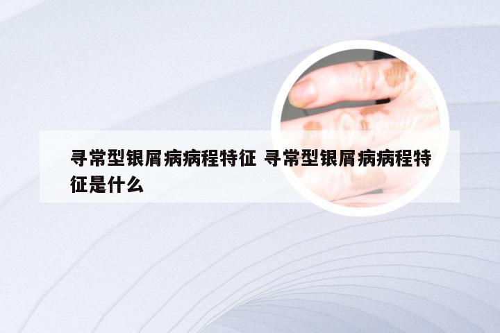 寻常型银屑病病程特征 寻常型银屑病病程特征是什么