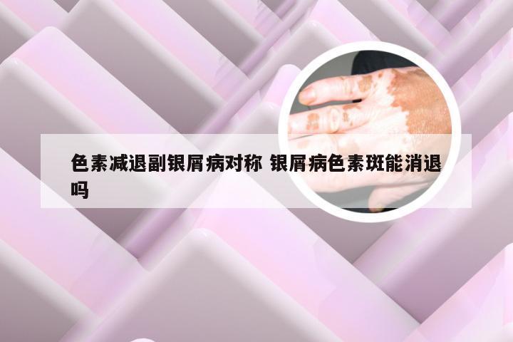 色素减退副银屑病对称 银屑病色素斑能消退吗