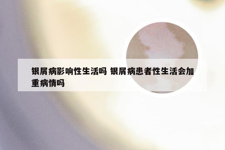 银屑病影响性生活吗 银屑病患者性生活会加重病情吗