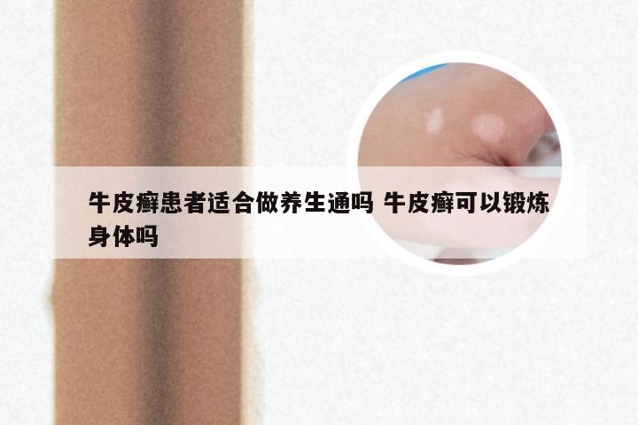 牛皮癣患者适合做养生通吗 牛皮癣可以锻炼身体吗