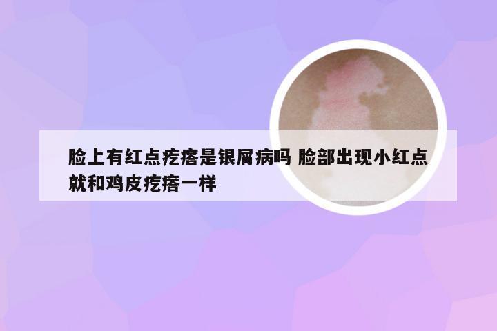 脸上有红点疙瘩是银屑病吗 脸部出现小红点就和鸡皮疙瘩一样