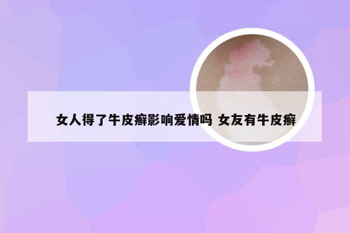 女人得了牛皮癣影响爱情吗 女友有牛皮癣