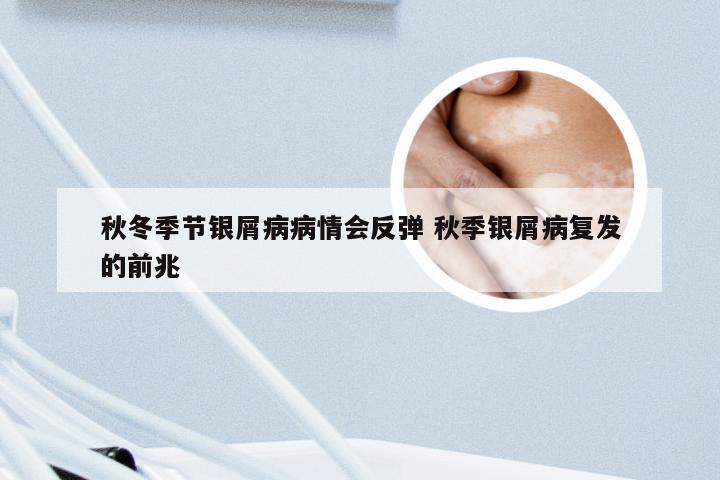 秋冬季节银屑病病情会反弹 秋季银屑病复发的前兆