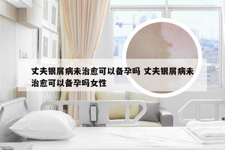 丈夫银屑病未治愈可以备孕吗 丈夫银屑病未治愈可以备孕吗女性