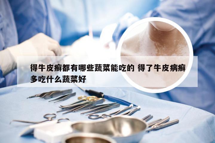 得牛皮癣都有哪些蔬菜能吃的 得了牛皮病癣多吃什么蔬菜好