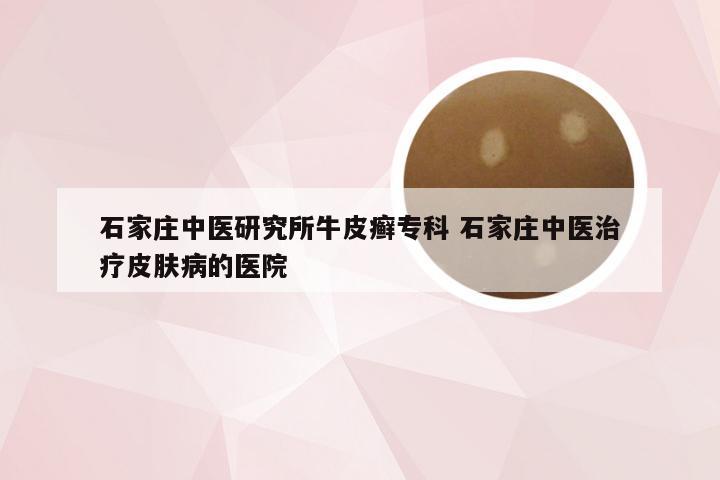 石家庄中医研究所牛皮癣专科 石家庄中医治疗皮肤病的医院