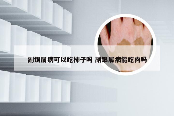 副银屑病可以吃柿子吗 副银屑病能吃肉吗