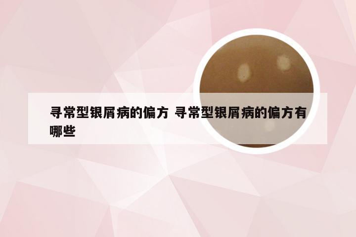 寻常型银屑病的偏方 寻常型银屑病的偏方有哪些