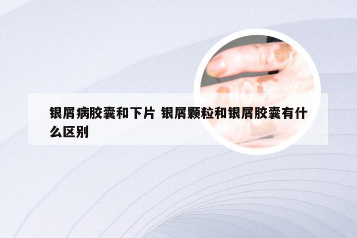 银屑病胶囊和下片 银屑颗粒和银屑胶囊有什么区别