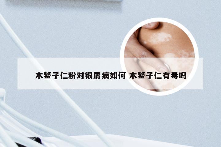 木鳖子仁粉对银屑病如何 木鳖子仁有毒吗