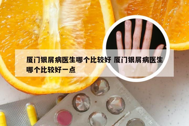 厦门银屑病医生哪个比较好 厦门银屑病医生哪个比较好一点