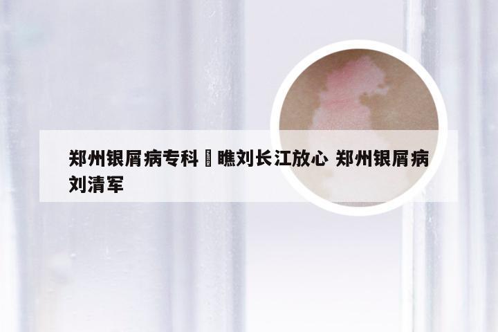 郑州银屑病专科來瞧刘长江放心 郑州银屑病刘清军