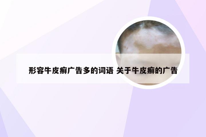 形容牛皮癣广告多的词语 关于牛皮癣的广告