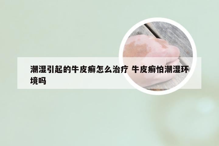 潮湿引起的牛皮癣怎么治疗 牛皮癣怕潮湿环境吗