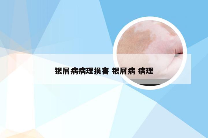 银屑病病理损害 银屑病 病理
