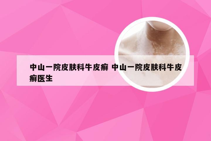 中山一院皮肤科牛皮癣 中山一院皮肤科牛皮癣医生