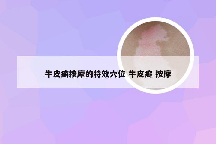 牛皮癣按摩的特效穴位 牛皮癣 按摩