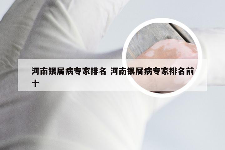 河南银屑病专家排名 河南银屑病专家排名前十