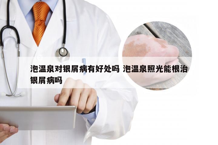 泡温泉对银屑病有好处吗 泡温泉照光能根治银屑病吗