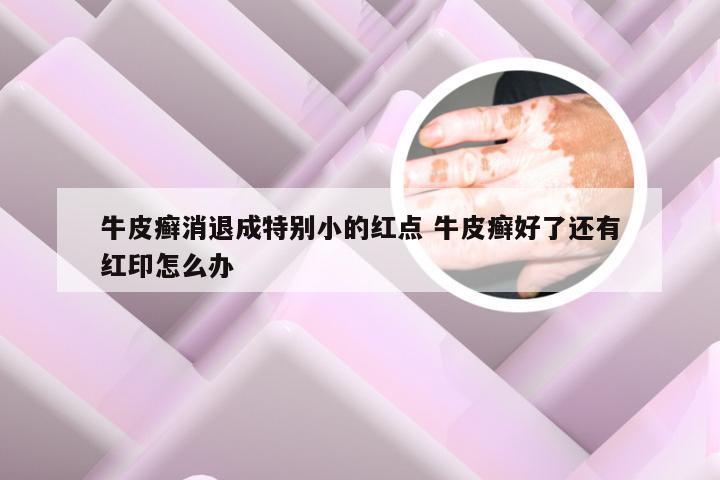 牛皮癣消退成特别小的红点 牛皮癣好了还有红印怎么办