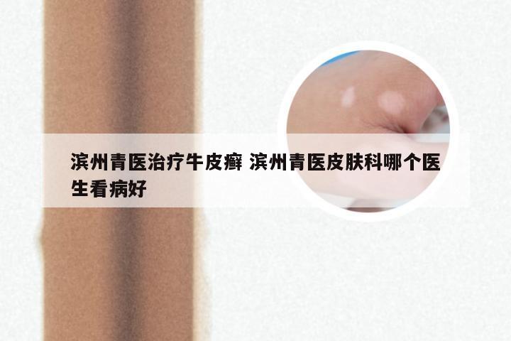 滨州青医治疗牛皮癣 滨州青医皮肤科哪个医生看病好